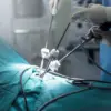 Why Triango 100 is One of the Best Surgical Lights for Endoscopy