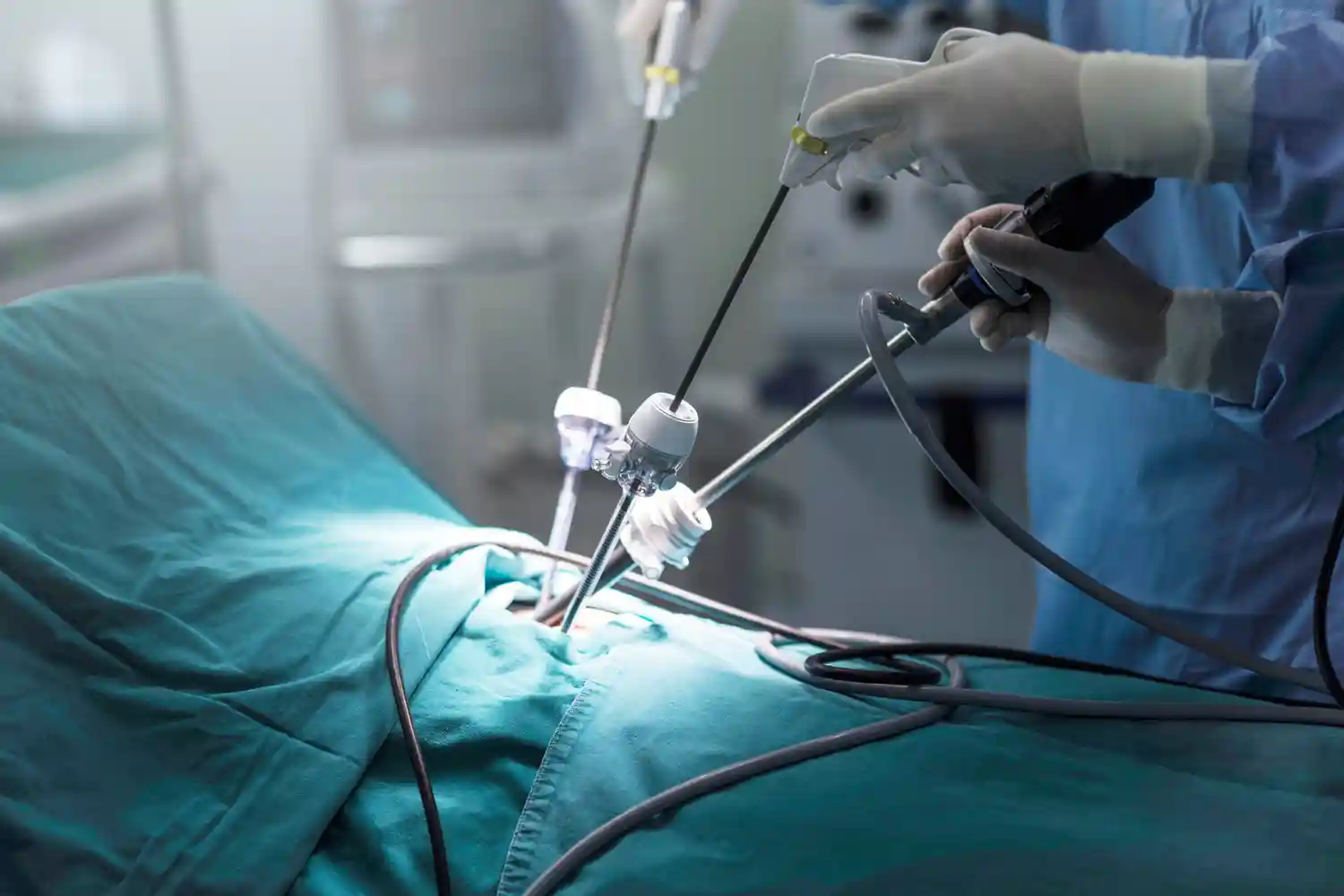 Why Triango 100 is One of the Best Surgical Lights for Endoscopy